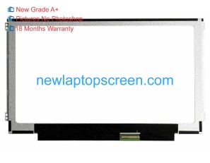 Lenovo chromebook n21-80mg 11.6 inch portátil pantallas